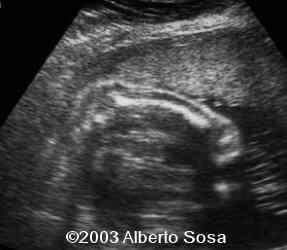 Diapositiva4