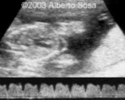 Diapositiva4