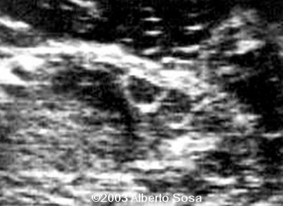 Diapositiva4