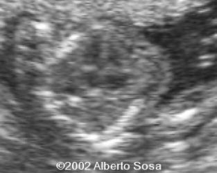 Diapositiva5 (2)