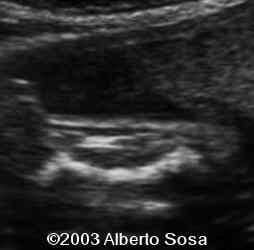 Diapositiva5