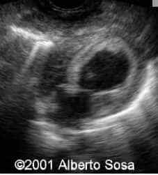 Diapositiva5
