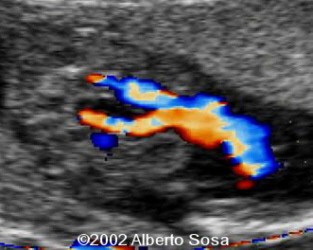Diapositiva6 (2)