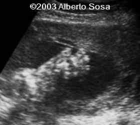 Diapositiva6