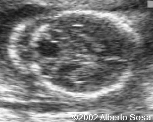 Diapositiva7 (2)