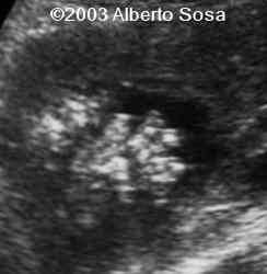 Diapositiva7