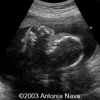 Diapositiva7