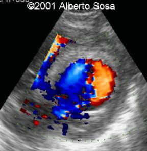 Diapositiva7