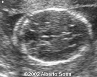 Diapositiva8 (2)