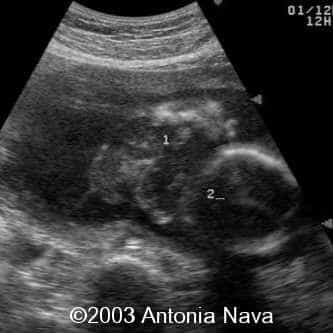 Diapositiva8