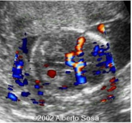 Diapositiva9 (2)