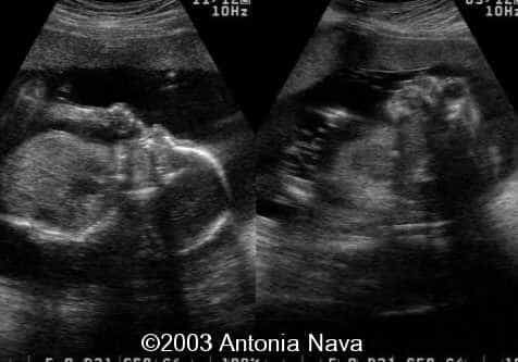 Diapositiva9