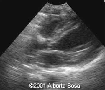 Diapositiva9
