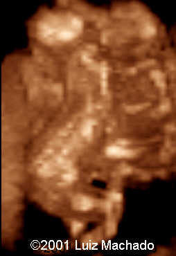 dipagus3