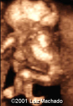 dipagus5