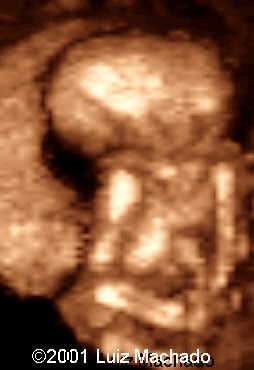 dipagus7