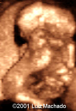 dipagus8