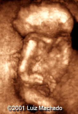 dipagus9