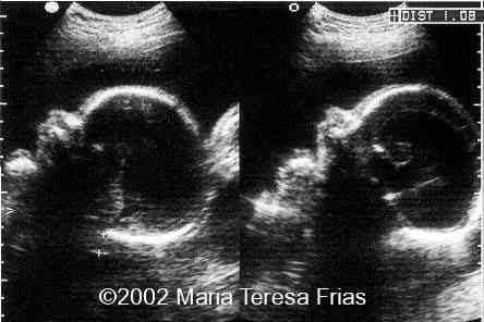 doble.perfil
