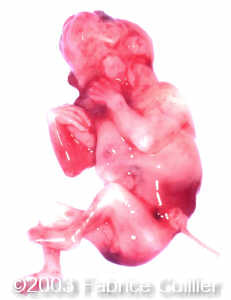 EMBRYON 1.