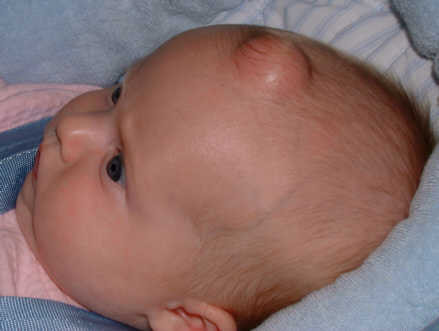 face1