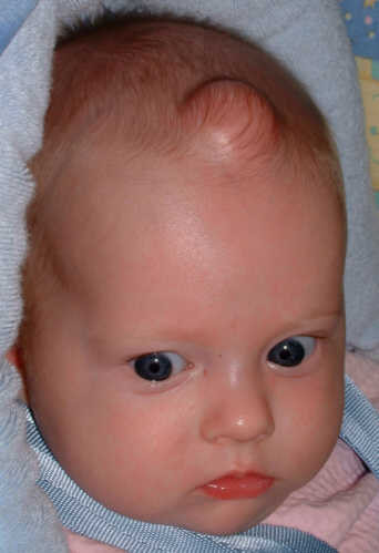 face2