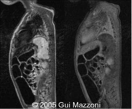 Fig 2b