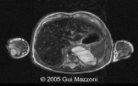 Fig 2c