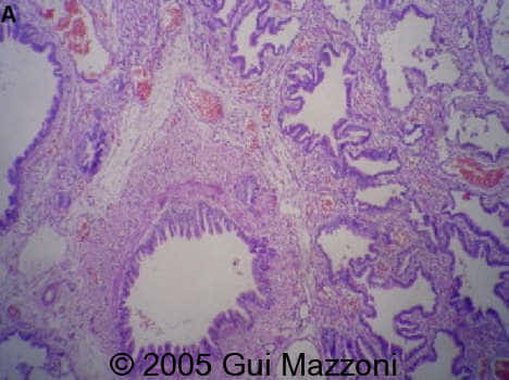 Fig 4a