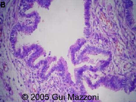 Fig 4b