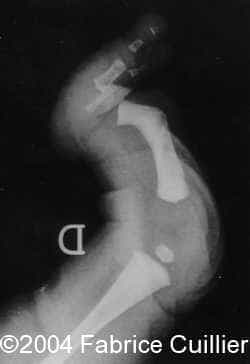 FIG 5A RADIOG 1.
