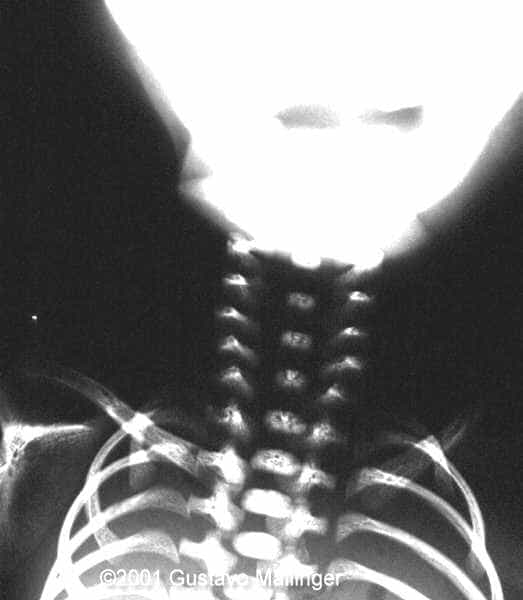 fig 9