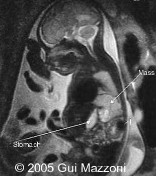 Fig. 1a
