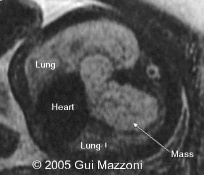 Fig. 1b
