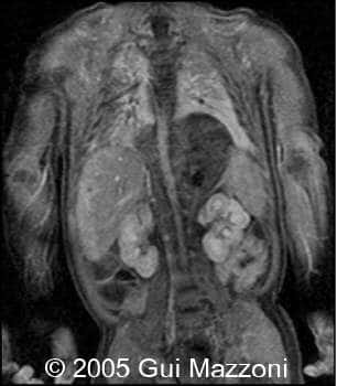 Fig. 2d