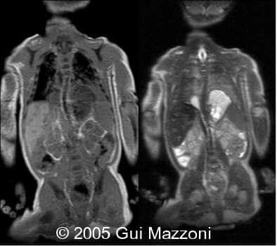 Fig.2a