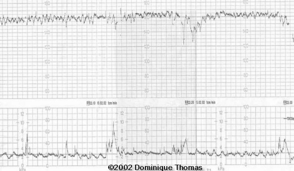 fig1 (2)
