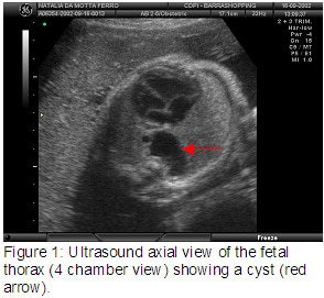 fig1