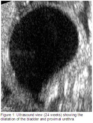 fig1