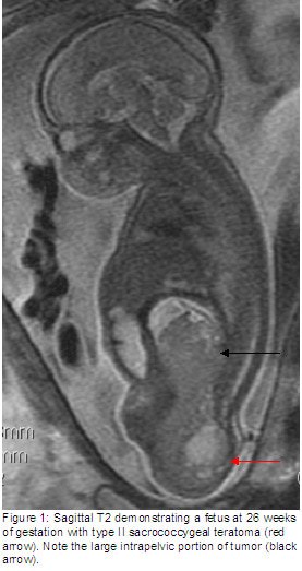 fig1