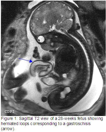 fig1