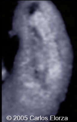 fig1