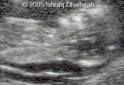 fig1