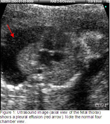 fig1