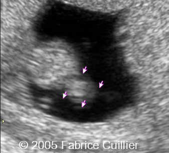 fig1