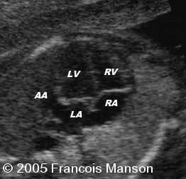 fig1