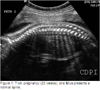 fig1