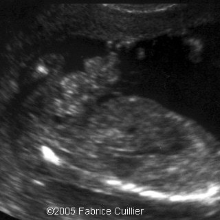 fig1