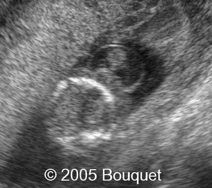 Fig1