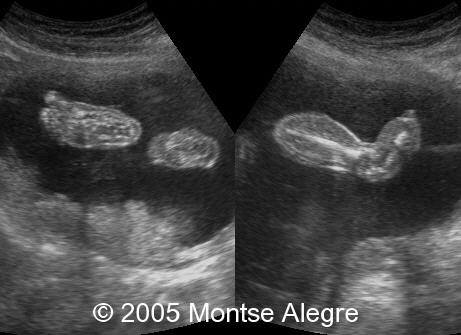 fig1